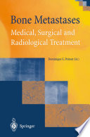 Bone metastases : medical, surgical, and radiological treatment /