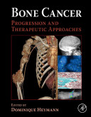 Bone cancer : progression and therapeutic approaches /