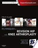 Techniques in revision hip and knee arthroplasty /