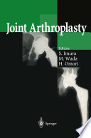 Joint arthroplasty /