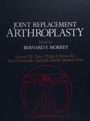 Joint replacement arthroplasty /