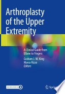 Arthroplasty of the Upper Extremity : A Clinical Guide from Elbow to Fingers /