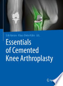 Essentials of Cemented Knee Arthroplasty /