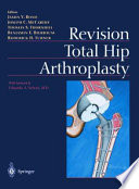 Revision total hip arthroplasty /
