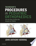 Tachdjian's procedures in pediatric orthopaedics : from the Texas Scottish Rite Hospital for Children /