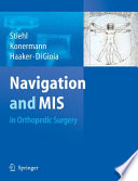 Navigation and MIS in orthopedic surgery /