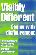 Visibly different : coping with disfigurement /