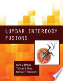 Lumbar interbody fusions /