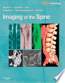 Imaging of the spine /
