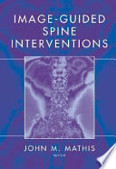 Image-guided spine interventions /
