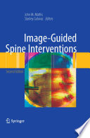 Image-guided spine interventions /