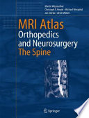 MRI atlas : orthopedics and neurosurgery : the spine /