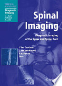 Spinal imaging : diagnostic imaging of the spine and spinal cord /
