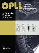 OPLL, ossification of the posterior longitudinal ligament /
