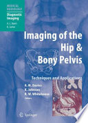Imaging of the hip & bony pelvis : techniques and applications /