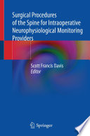 Surgical Procedures of the Spine for Intraoperative Neurophysiological Monitoring Providers /