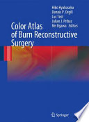 Color atlas of burn reconstructive surgery /