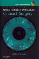 Cataract surgery /