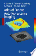 Atlas of fundus autofluorescence imaging /