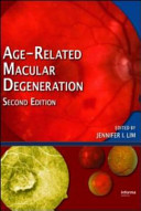 Age-related macular degeneration /