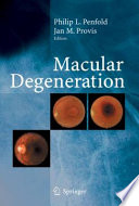 Macular degeneration /