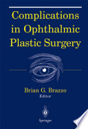 Complications in ophthalmic plastic surgery /