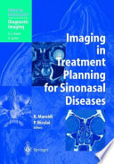 Imaging in treatment planning for sinonasal diseases /