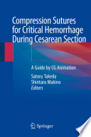 Compression Sutures for Critical Hemorrhage During Cesarean Section : A Guide by CG Animation /