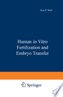 Human in vitro fertilization and embryo transfer /