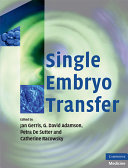 Single embryo transfer /