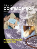 Atlas of contraception /