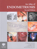 An atlas of endometriosis /