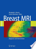 Breast MRI : diagnosis and intervention /