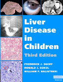 Liver disease in children /