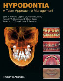 Hypodontia : a team approach to management /