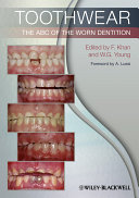 Toothwear the ABC of the worn dentition /