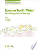 Erosive tooth wear : from diagnosis to therapy /