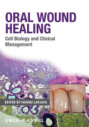 Oral wound healing : cell biology and clinical management /