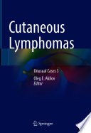 Cutaneous Lymphomas : Unusual Cases 3 /
