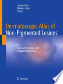 Dermatoscopic Atlas of Non-Pigmented Lesions : Case-based Analysis and Management Options /