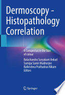 Dermoscopy - Histopathology Correlation  : A Conspectus in the Skin of colour /