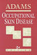 Occupational skin disease /