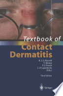 Textbook of contact dermatitis /