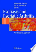 Psoriasis and psoriatic arthritis : an integrated approach /