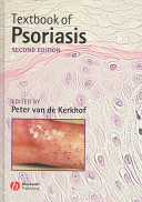 Textbook of psoriasis /