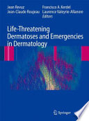 Life-threatening dermatoses and emergencies in dermatology /