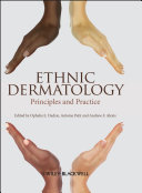 Ethnic Dermatology : Principles and Practice /
