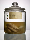 Malformed : forgotten brains of the Texas State Mental Hospital /
