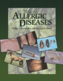 Atlas of allergic diseases /