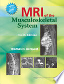 MRI of the musculoskeletal system /